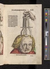 Go to image 63.